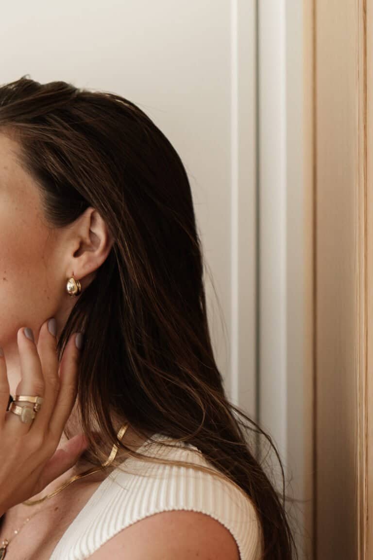 How to Treat Hyperpigmentation Naturally: A Complete Guide