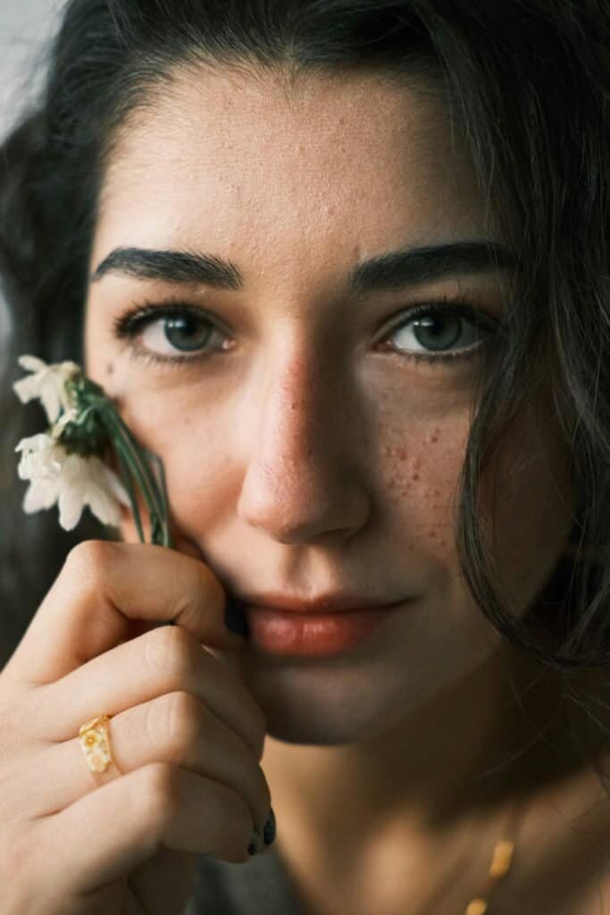 Close-up portrait of a woman with acne skin holding a small white flower near her face, reflecting natural beauty and the search for gentler science-backed acne solutions