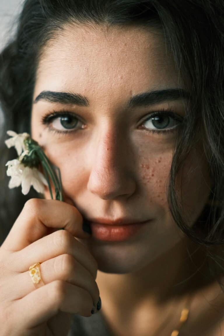 8 Botanical Ingredients That Help Treat and Prevent Acne